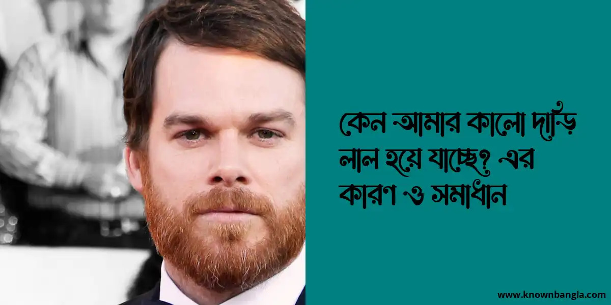 কেন আমার কালো দাড়ি লাল হয়ে যাচ্ছে? এর কারণ ও সমাধান