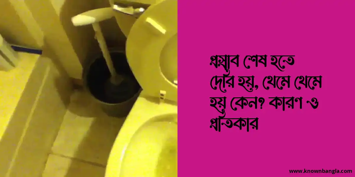 প্রস্রাব শেষ হতে দেরি হয়, থেমে থেমে হয় কেন? কারণ ও প্রতিকার