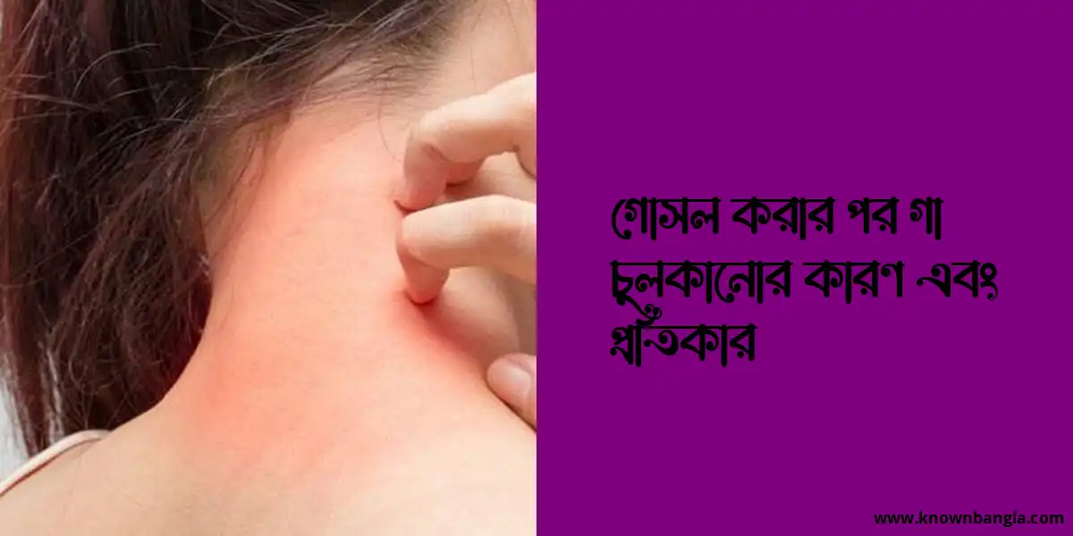 গোসল করার পর গা চুলকানোর কারণ এবং প্রতিকার