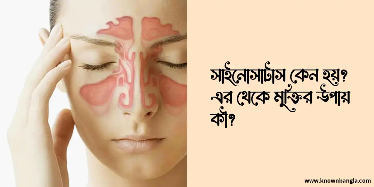 সাইনোসাটাস কেন হয়? এর থেকে মুক্তির উপায় কী?