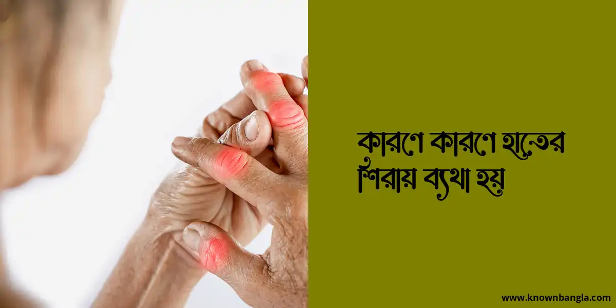 কারণে কারণে হাতের শিরায় ব্যথা হয়