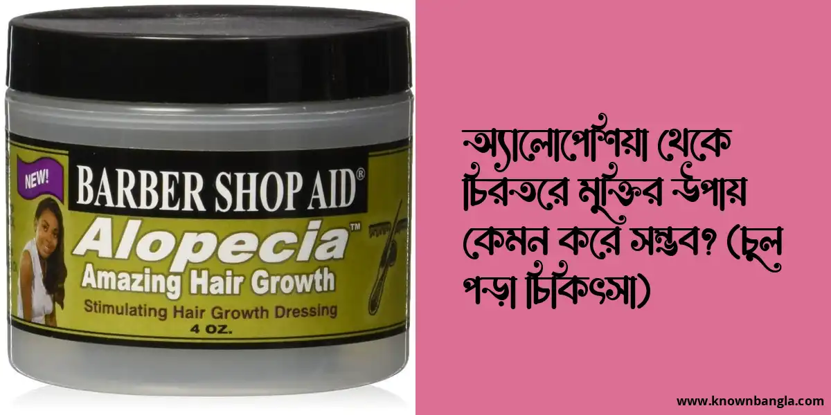 অ্যালোপেশিয়া থেকে চিরতরে মুক্তির উপায় কেমন করে সম্ভব?