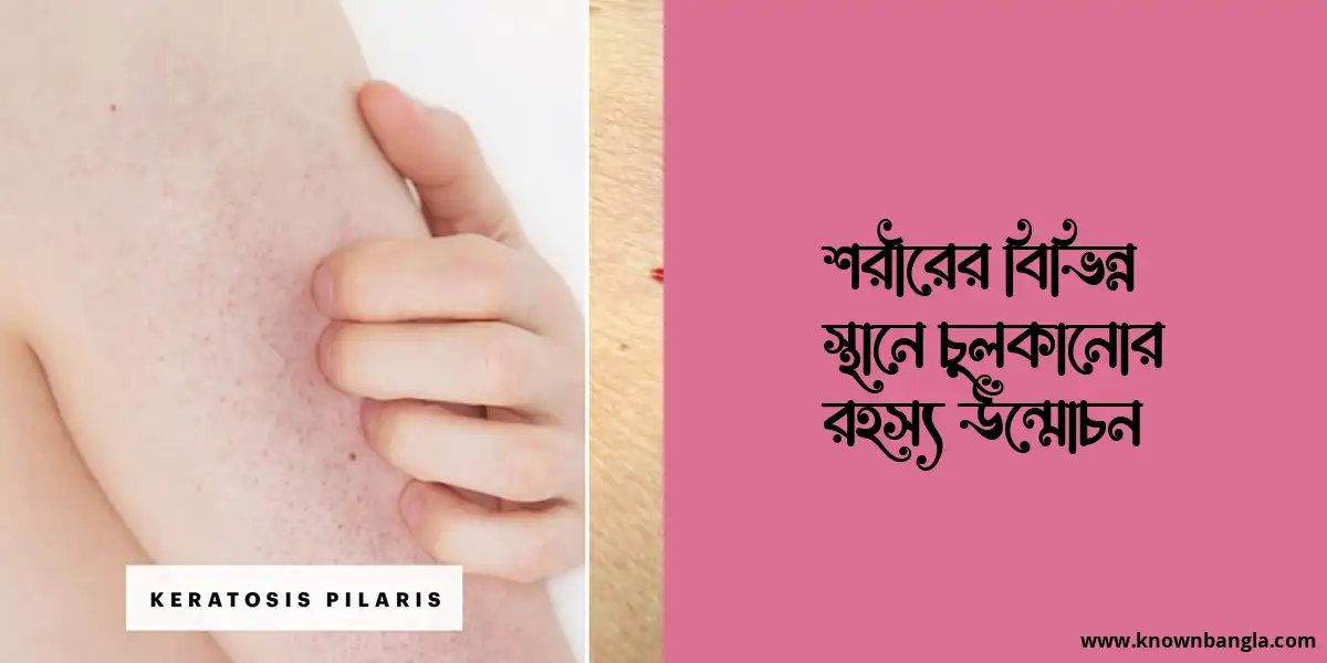 শরীরের বিভিন্ন স্থানে চুলকানোর রহস্য উন্মোচন