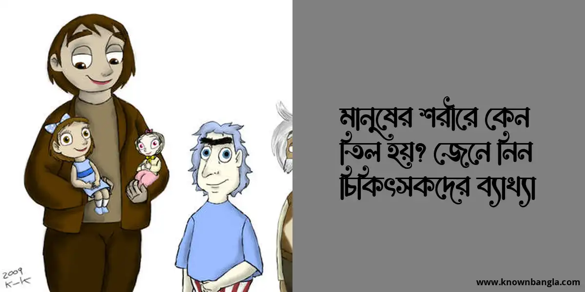 মানুষের শরীরে কেন তিল হয়? জেনে নিন চিকিৎসকদের ব্যাখ্যা