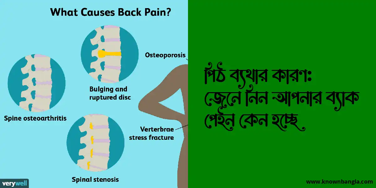 পিঠ ব্যথার কারণ: জেনে নিন আপনার ব্যাক পেইন কেন হচ্ছে