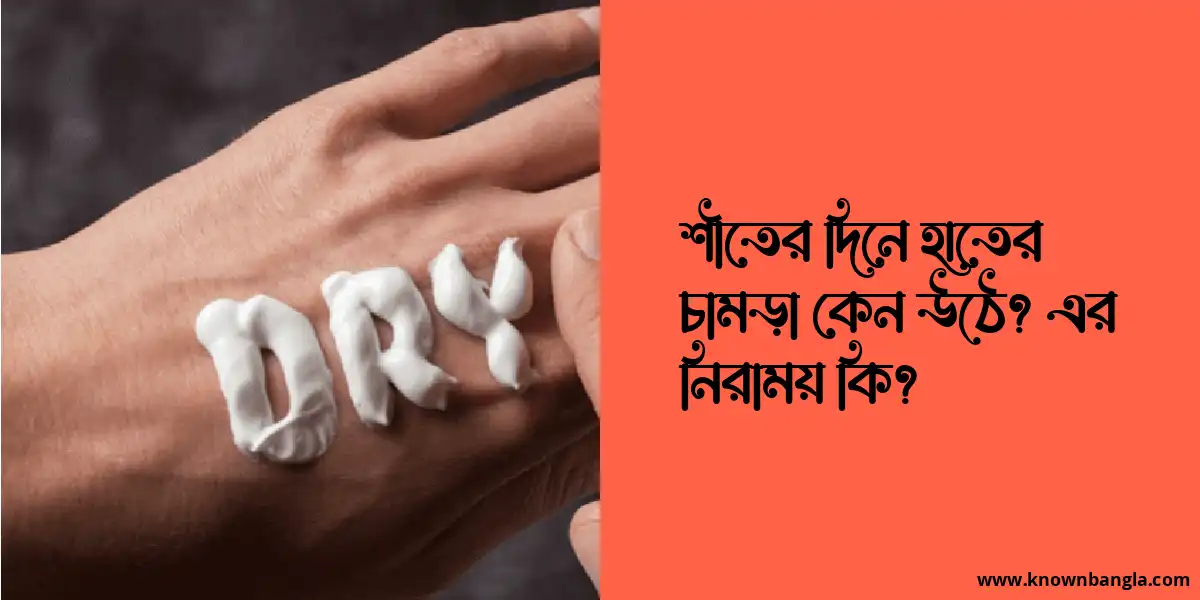 শীতের দিনে হাতের চামড়া কেন উঠে? এর নিরাময় কি?